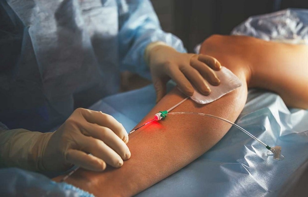 Гнойная хирургия и хирургические осложнения сахарного диабета